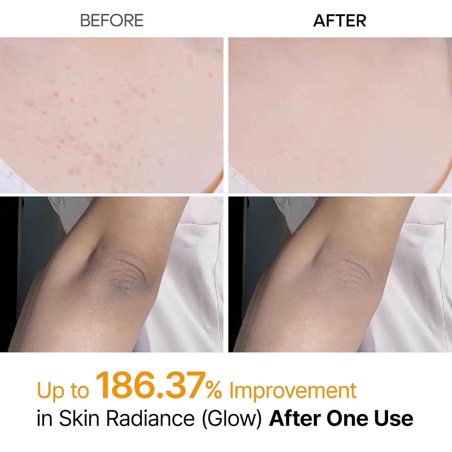 Viral Dr.Melaxin Body Peel Shot Spray Face Peeling Kojic Acid Turmeric Spray